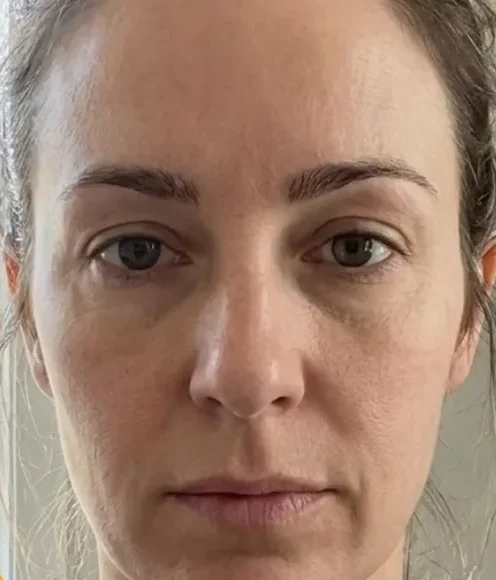 Before using bakuchiol oil