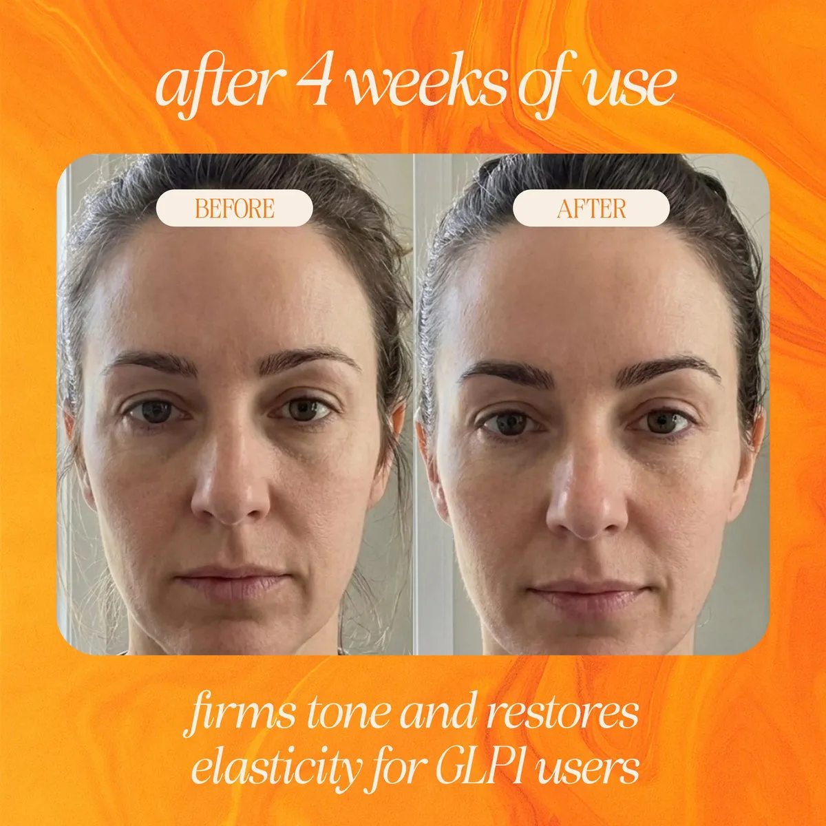 Before and after 4 weeks of use